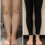 【銀座】脚が太く見える本当の理由