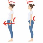 【銀座】反り腰が体型を崩す理由